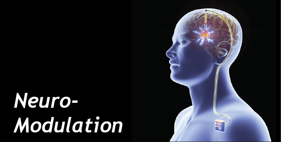 Neuromodulation